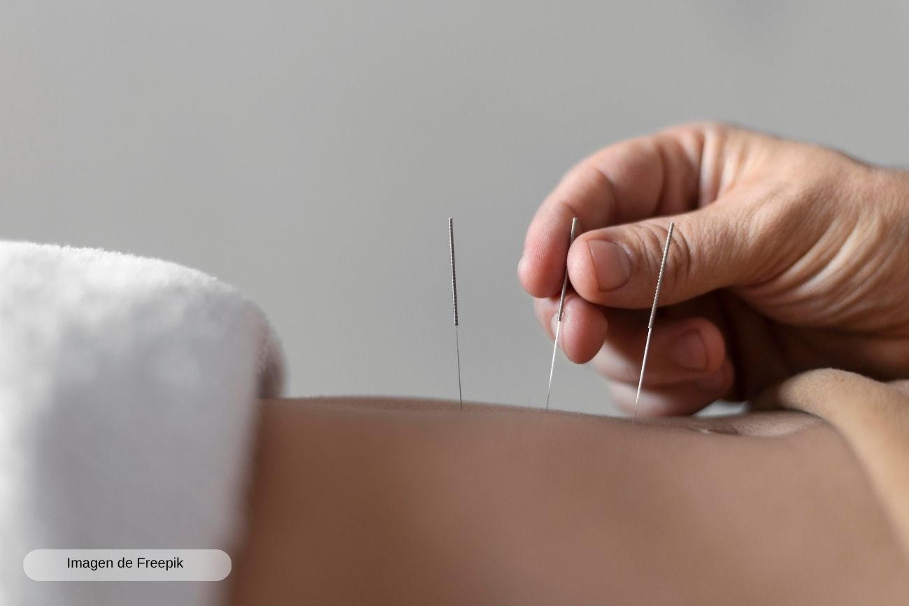 Punción seca en A Guarda